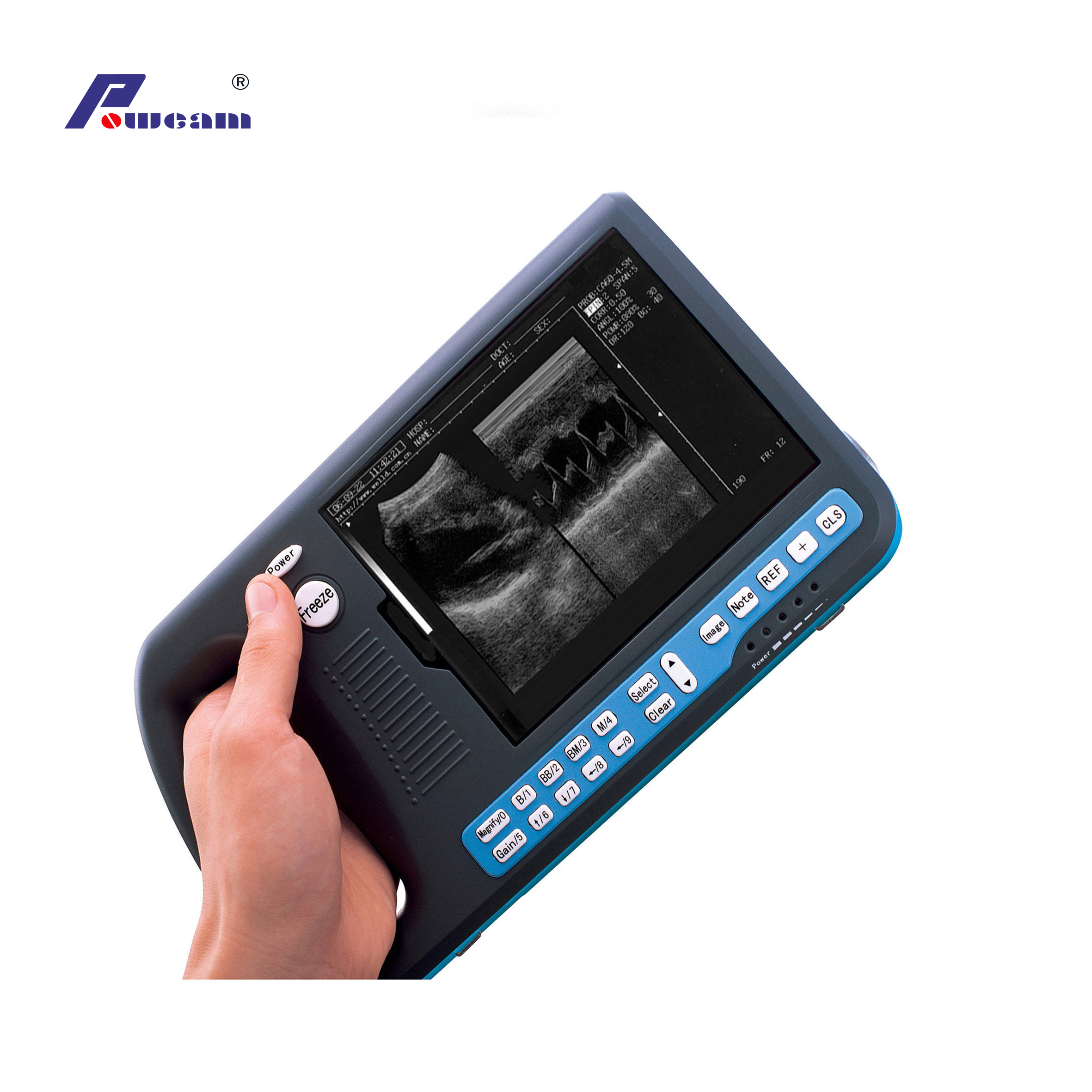 Digital-Palmtop-Ultraschallscanner (wwwb3000)