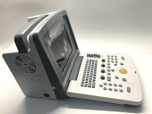 Tragbares Laptop-Ultraschall-Scanner-Gerät mit linearer transvaginaler Sonde Preis