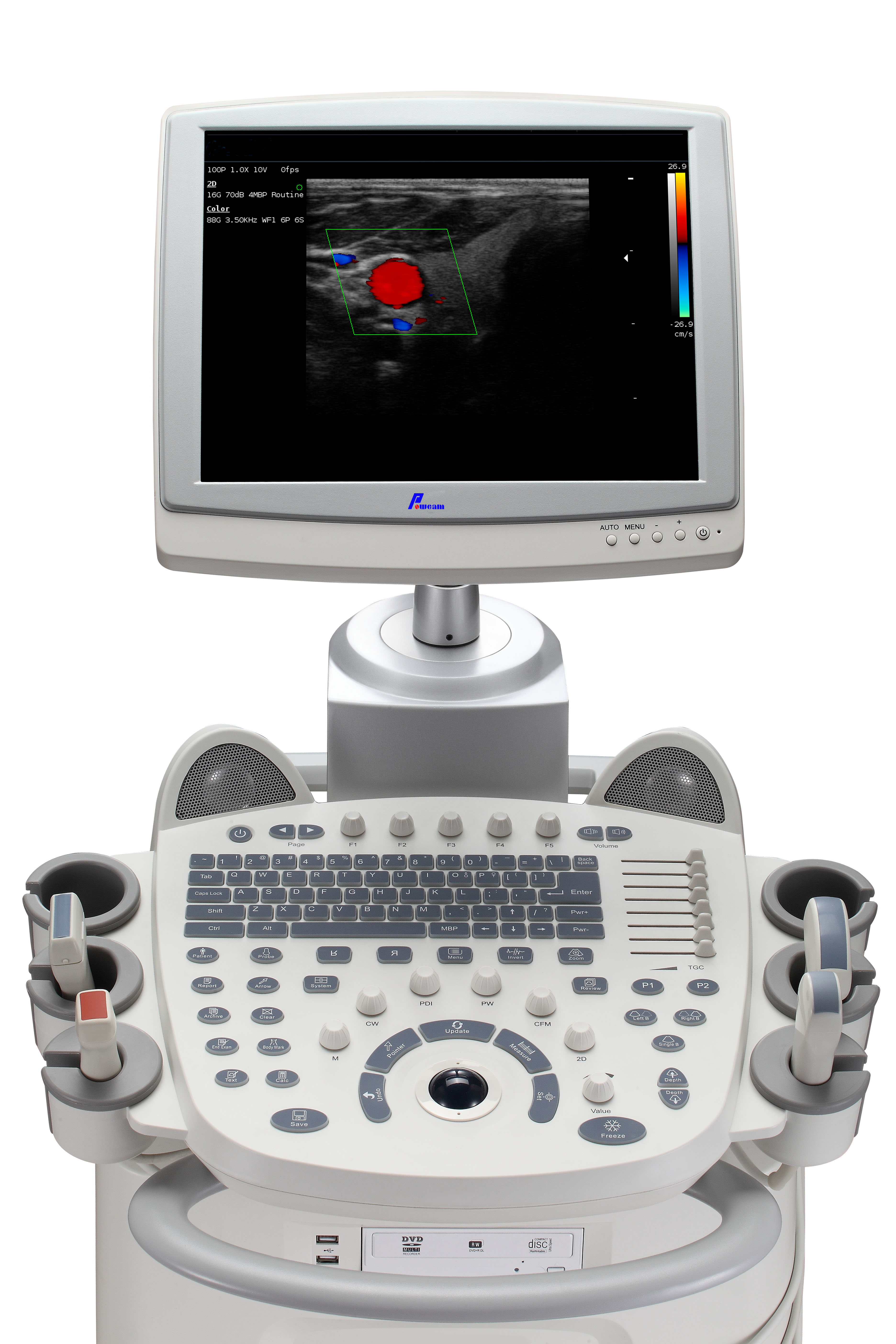 Krankenhaus medizinischer tragbarer und mobiler Sonoscape 4D Farbdoppler