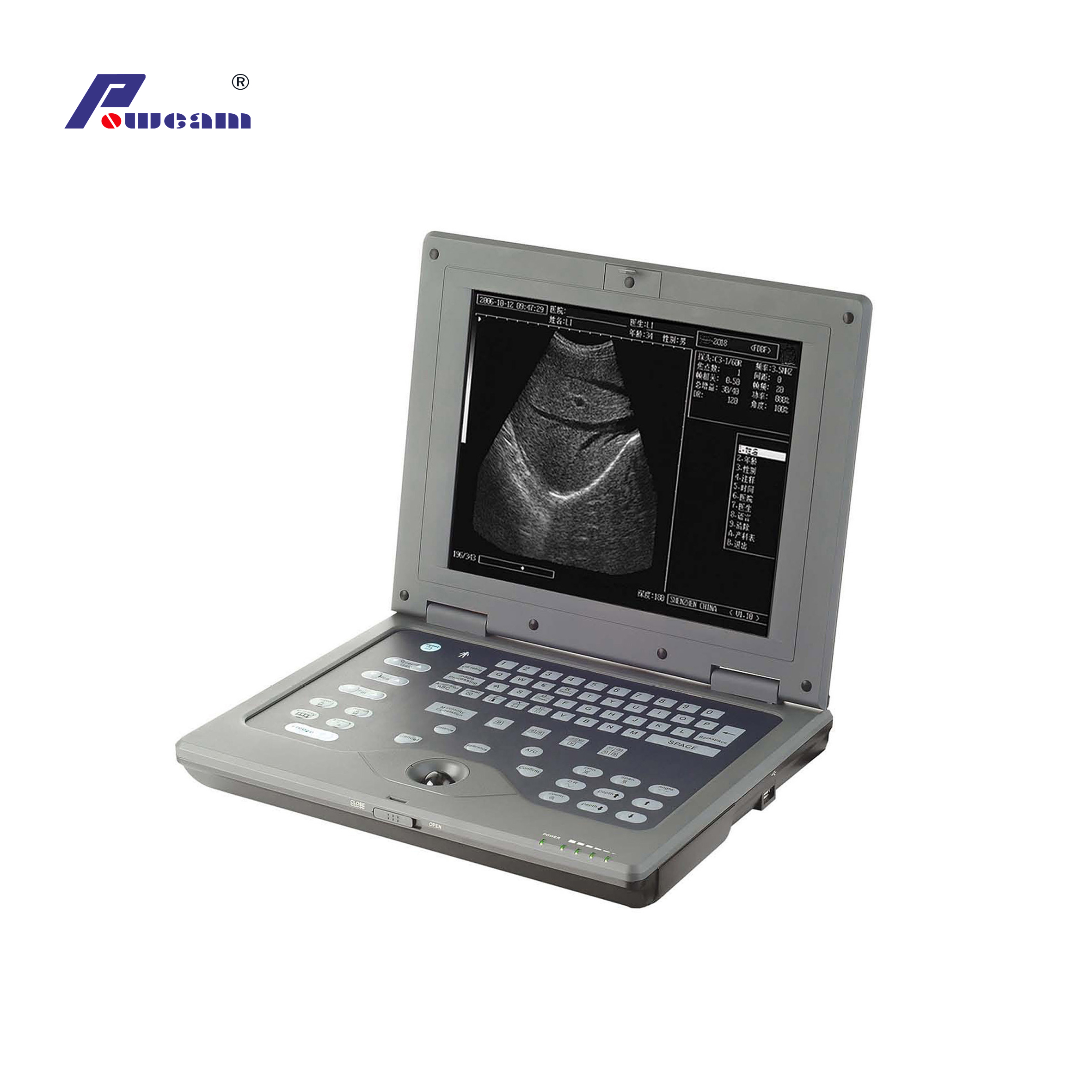 Laptop-Veterinär-Ultraschallscanner (wwwb2018p)